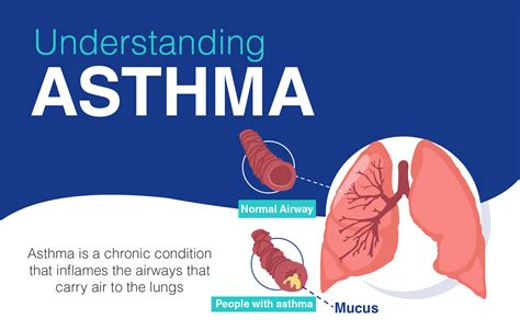 What Causes Bronchitis Asthma